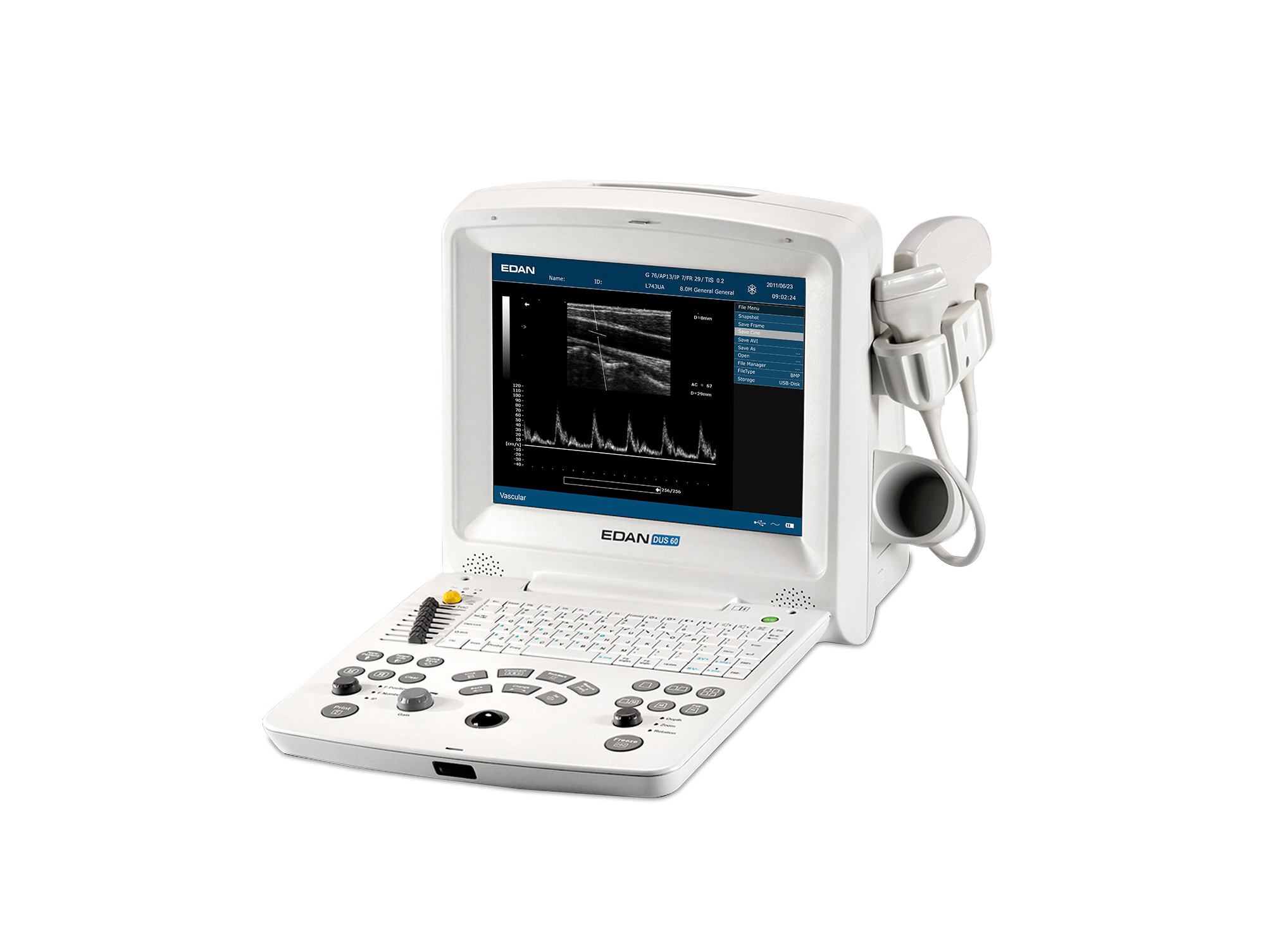 EDAN DUS 60 Digital Ultrasonic Diagnostic Imaging System جهاز الموجات فوق الصوتية