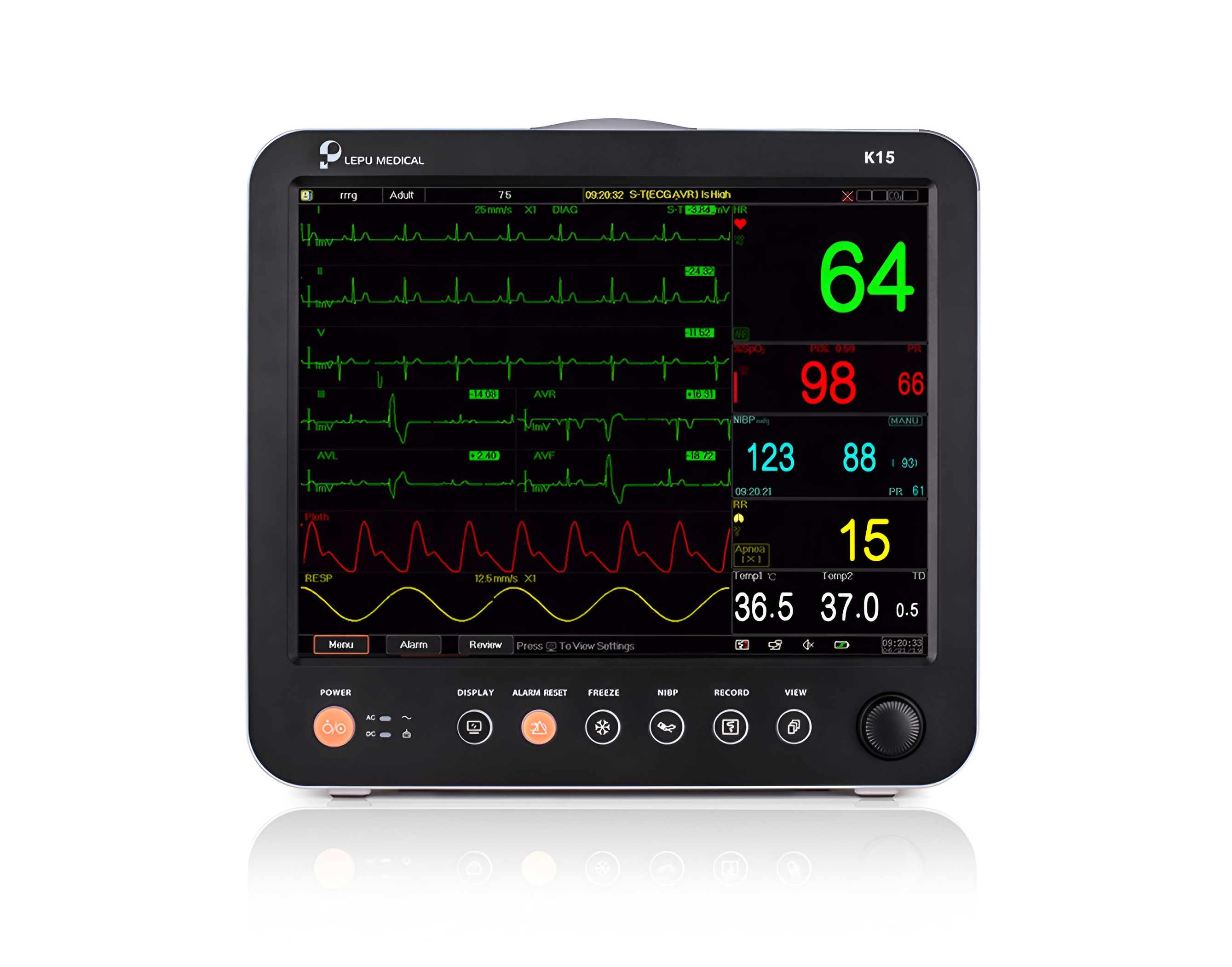 Patient Monitor – K15 Multi-Parameters15′ Touch Printer Creative,جهاز مونيتور طبي متعدد الوظائف K15